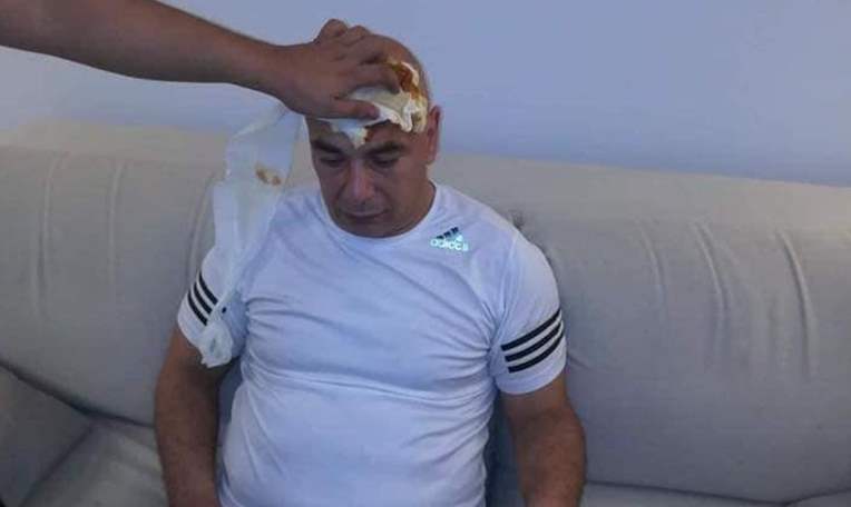 جماهير فيتاكلوب تعتدي بالضرب علي حسام حسن