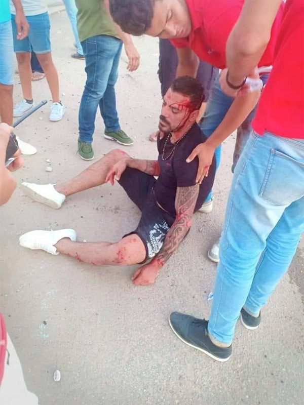 عمرو زكي بعد تعرضه لحادث سير: هرجع أحسن من الأول
