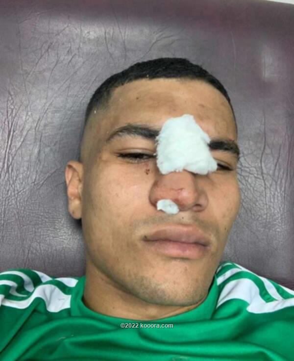 لاعب إنبي يصاب بكسر في الأنف خلال التدريبات